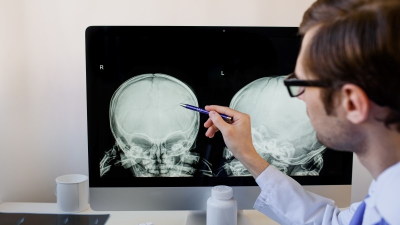 Man radiologist analyzing a child skull x ray