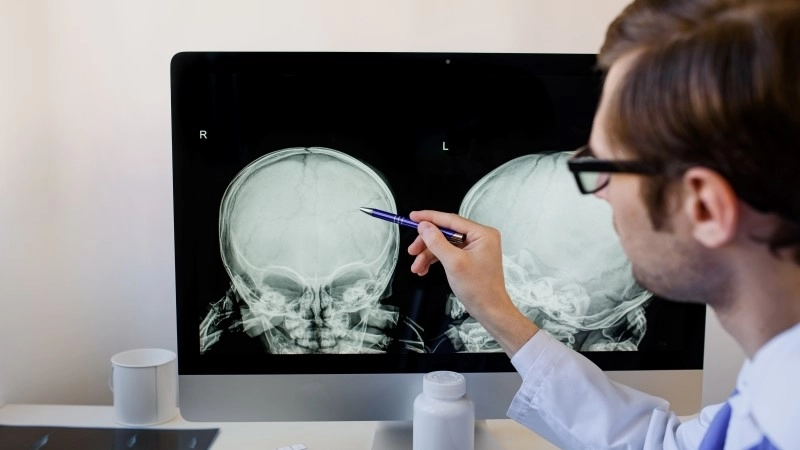 Man radiologist analyzing a child skull x ray