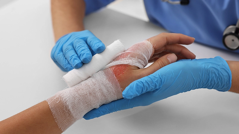 Burn Injury