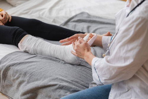 doctor in white coat examining patient leg wrapped in medical cast
